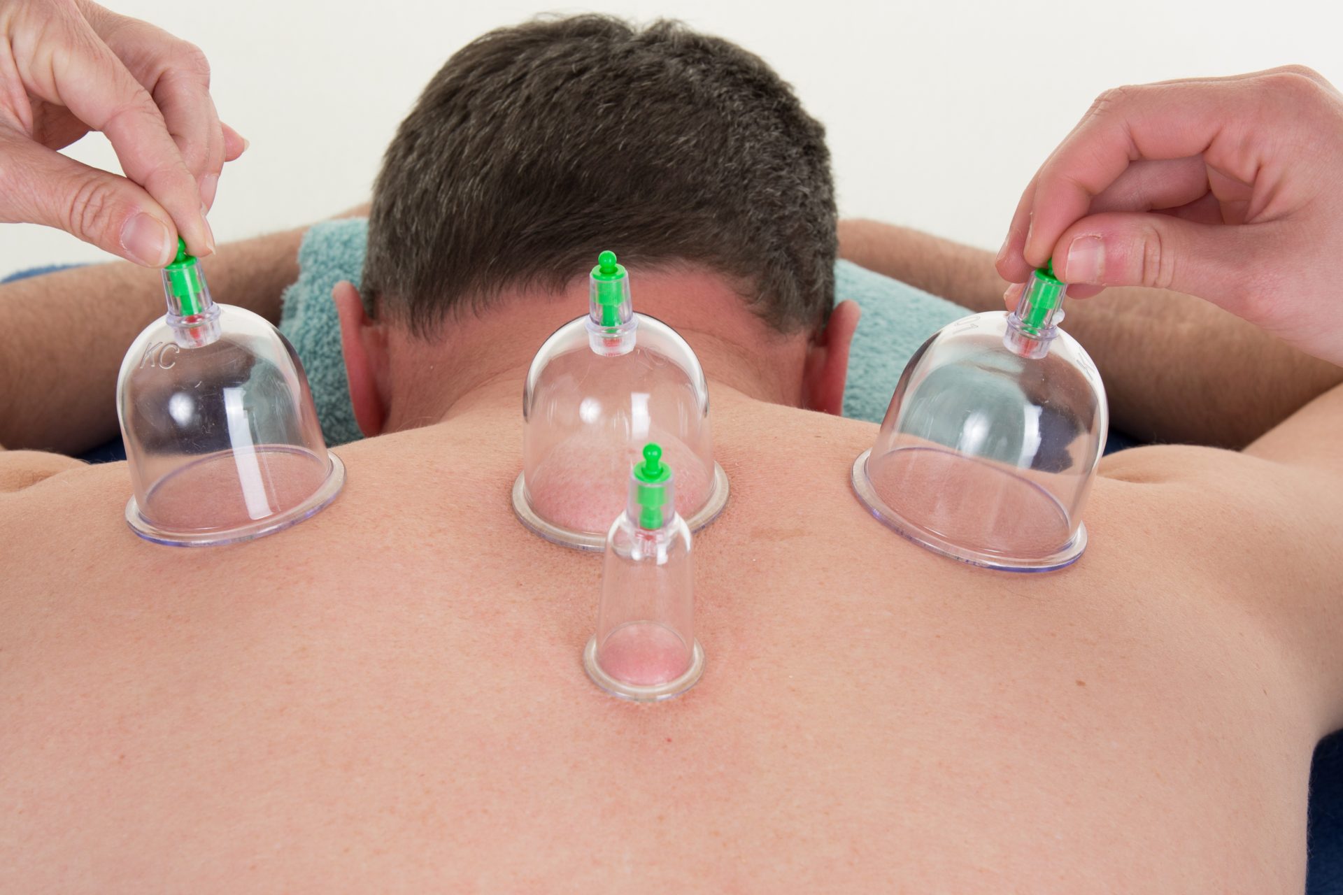Instrument Assisted Soft Tissue Mobilization Cupping College Station